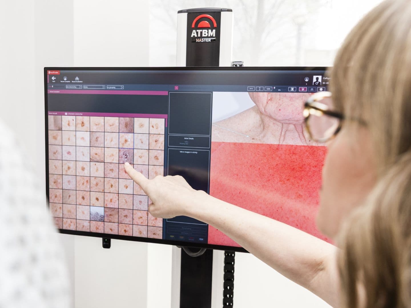 Mole mapping service background